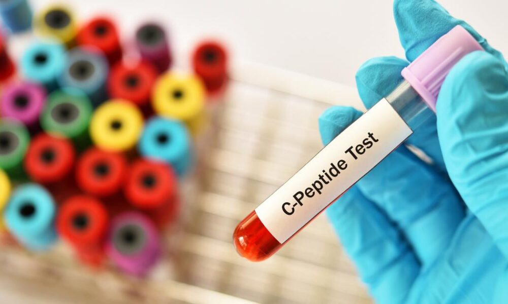 protocolo anti-aging peptídeos