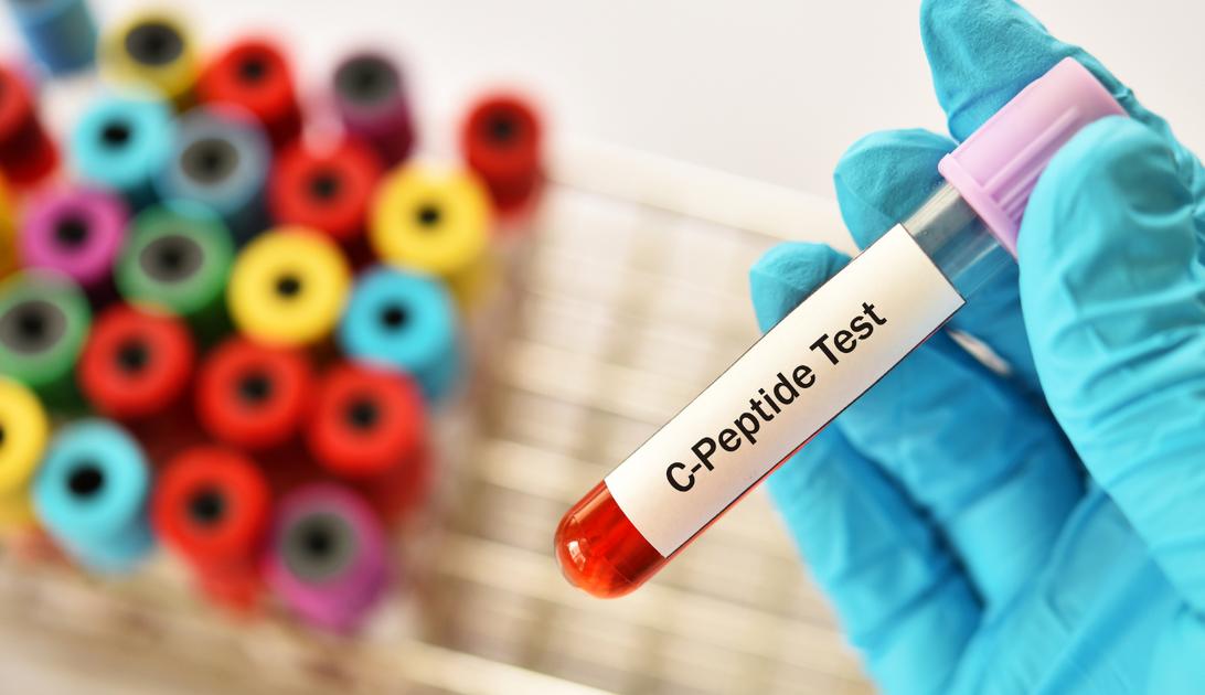 protocolo anti-aging peptídeos